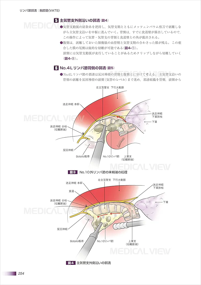 がん研スタイル 癌の標準手術 肺癌 肺癌 (がん研スタイル 癌の標準手術) | 奥村 栄, 文 敏景(編集